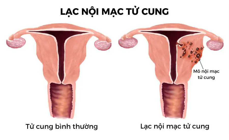 Bài viết nổi bật
